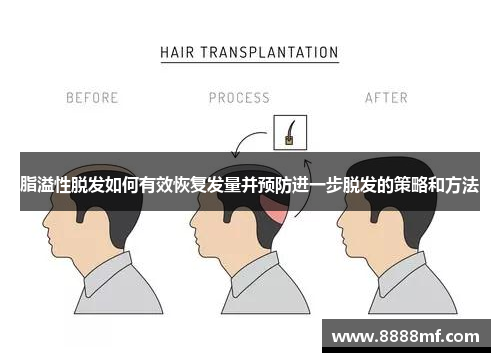 脂溢性脱发如何有效恢复发量并预防进一步脱发的策略和方法